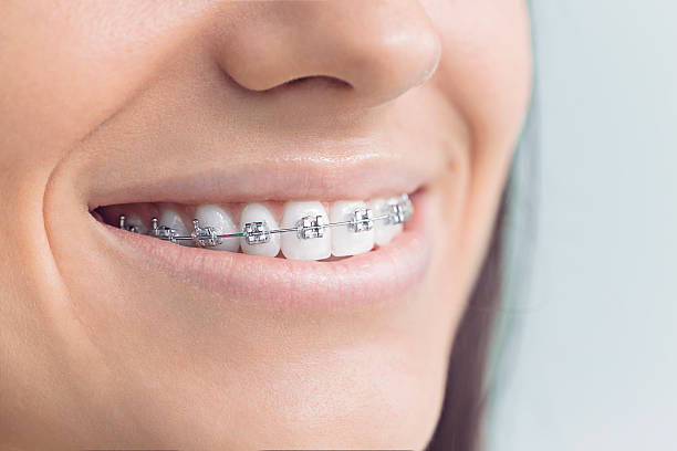 Trusted Desert Palms, CA Dental Services Experts